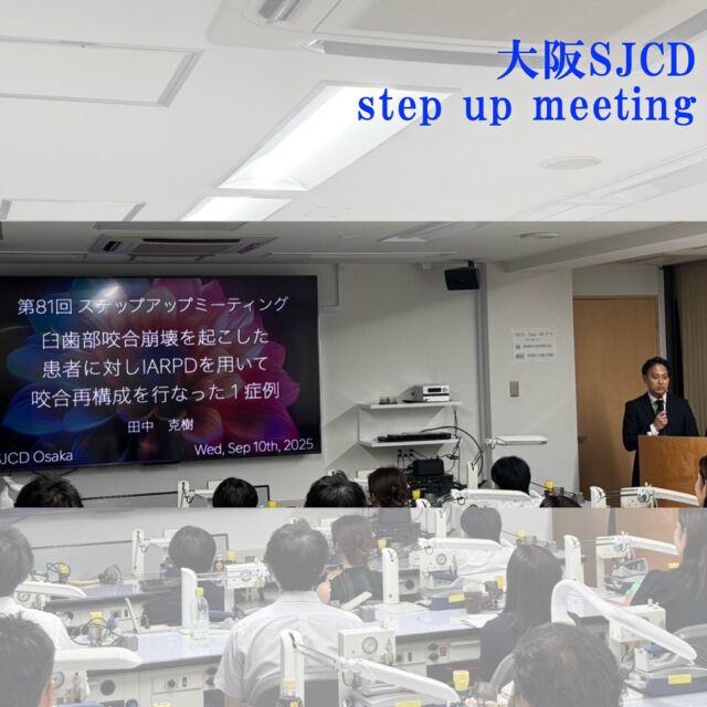 2025年9月10日に堂島SJCD研修センターにて第81回ステップアップミーティングが開催されました.
今回は「臼歯部咬合崩壊を起こした患者に対しIARPDを用いて咬合再構成を行った一症例」と題し，スマイル会よしだ歯科の田中克樹先生にご発表頂きました.

68歳の男性で臼歯部が欠損しており噛めない事を主訴に来院された患者さんに対してインプラントと義歯を用いて咬合再構成を行った症例でした.
基礎資料の収集はもちろんのこと，
診査診断も細かく分析されており，
特に補綴設計に関してはさまざまな意見が飛び交い
素晴らしいディスカッションになりました.
インプラントと義歯を用いていることもあり，
クラウンワークの技工士，デンチャーワークの技工士，歯科医師のそれぞれのコミュニケーションがいかに必要かを学べる機会になりました.
ぶっちゃけトークでは現地ならではの本音の意見や中には厳しいご意見もありましたがそれこそが勉強になるなと感じました！
田中理事からはプロビジョナルレストレーションの作り方に関して動画を用いて勘所のレクチャーがあり現地参加の方は非常に為になった回でした.

#日本臨床歯科学会 
#日本臨床歯科学会大阪支部 
#大阪SJCD
#咬合再構成
#歯科勉強会
#三位一体
#歯科医師
#歯科衛生士
#歯科技工士
#プロビジョナルレストレーション